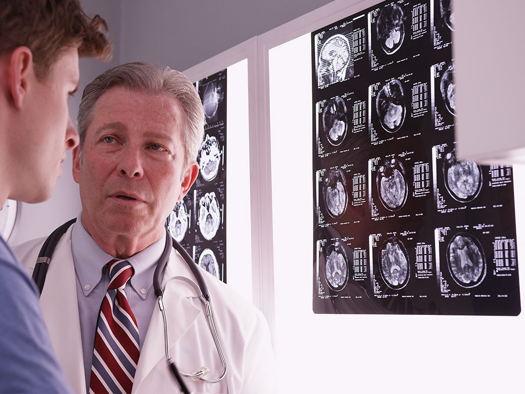 ALS Bulbar-Onset Patients Show Extensive Brain Damage