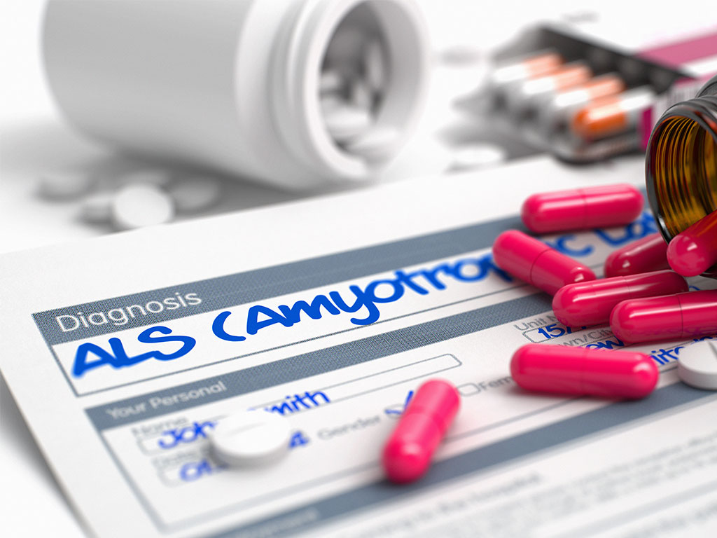 Protection Against ALS Damage Using Anti-Inflammation Properties of Masitinib