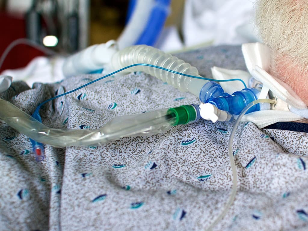 ALS patient with a tracheostomy