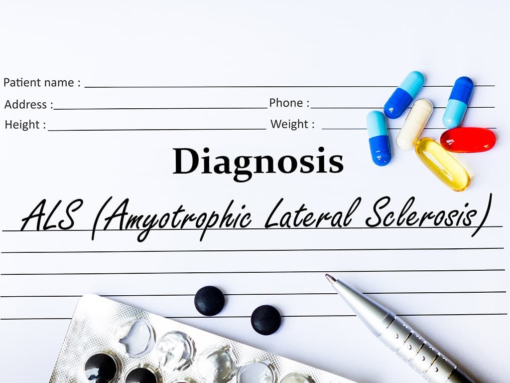 ALS prognosis