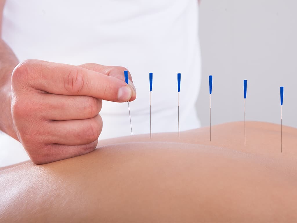 Acupuncture ALS therapy
