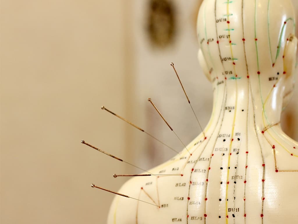 Acupuncture points