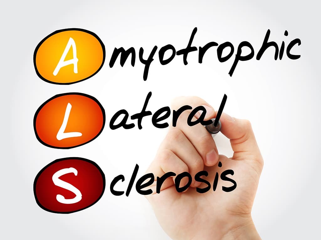 Early symptoms associated with ALS