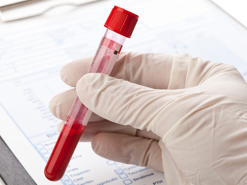 ALS blood tests