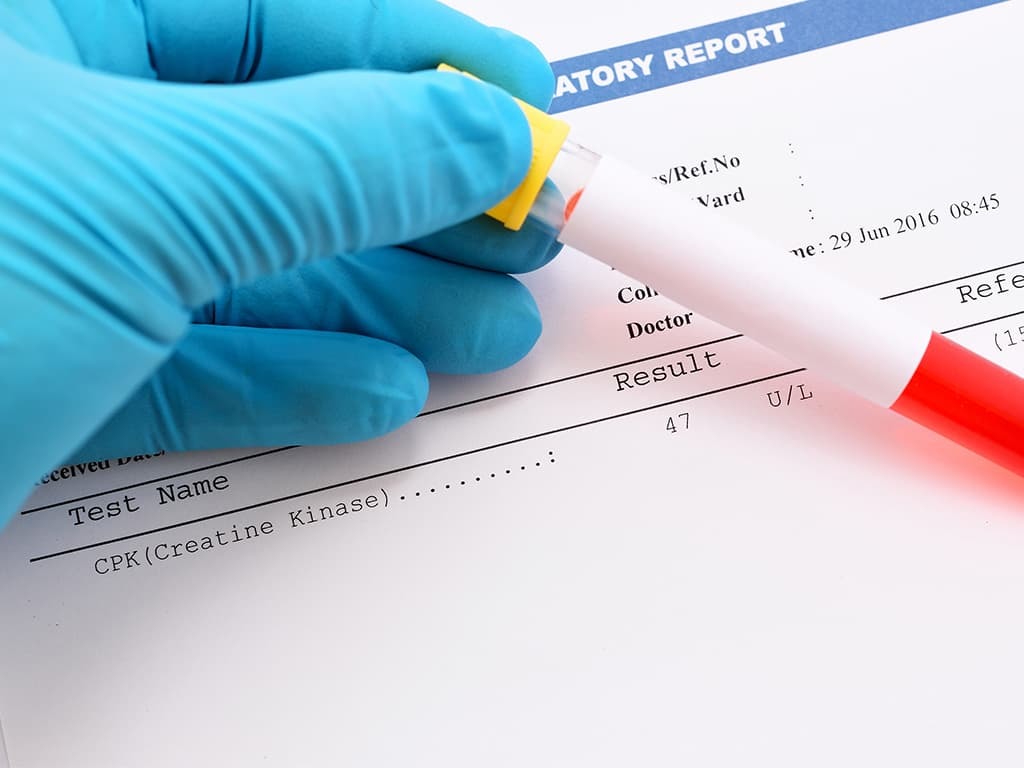 Creatine kinase test