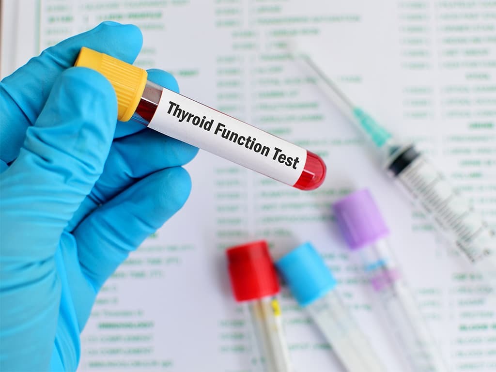 Thyroid function tests