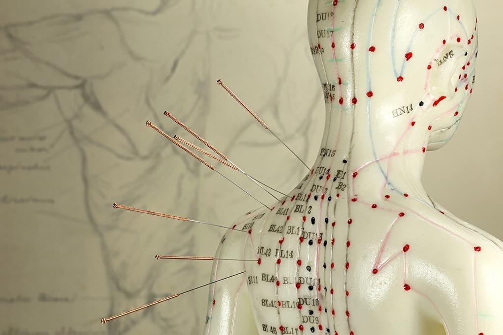 Acupuncture model