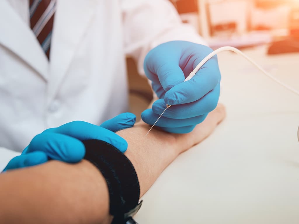 ALS nerve tests